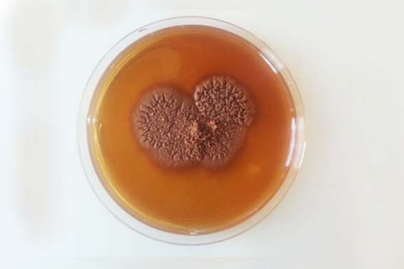 Mycetoma laboratory analysis